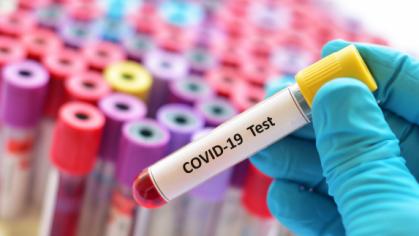 COVID 19 test tube